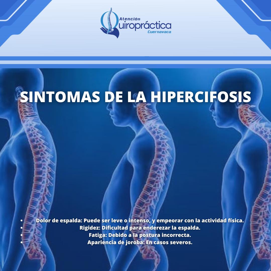 Síntomas de hipercifosis